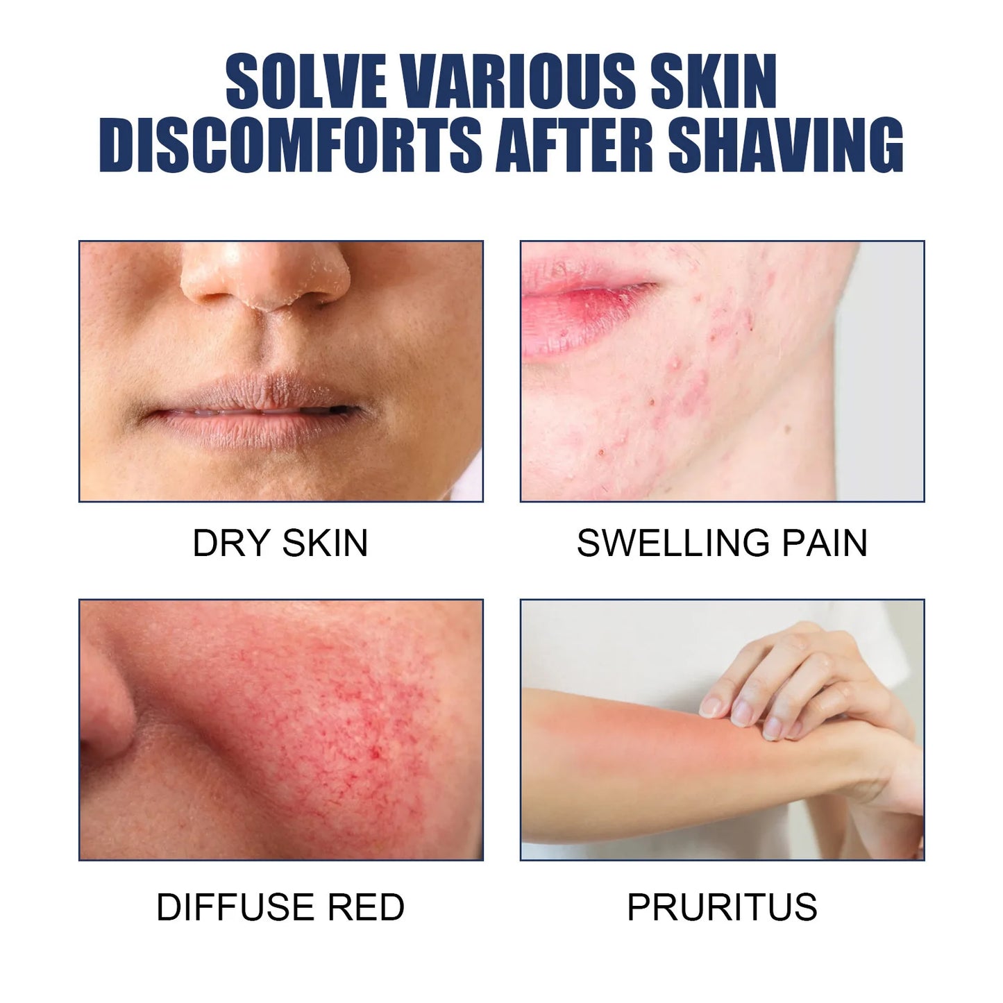 After Shave Repair Lotions Prevent Ingrowns Hair Treatment Smooth Body Skin Reduce Dark Spots Redness Serum for Vanish Pimple