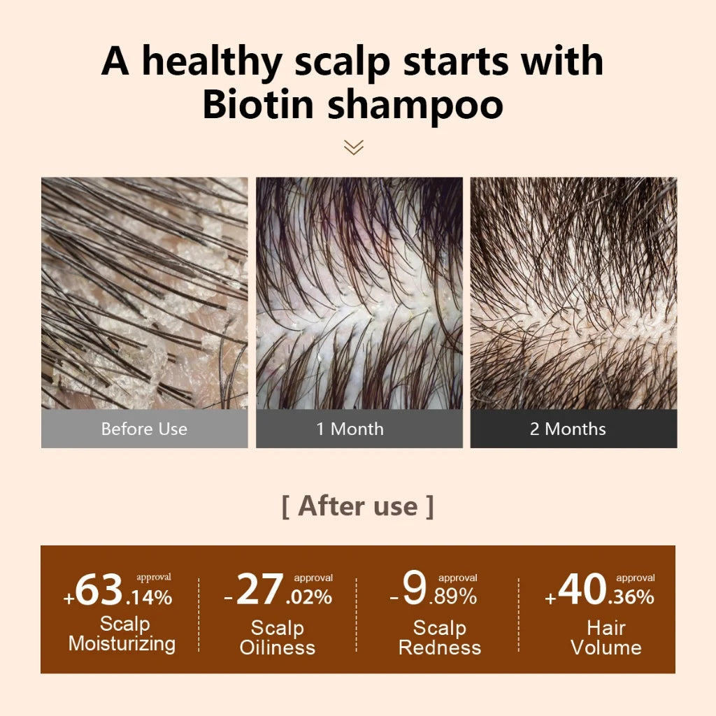 PURC Biotin Hair Shampoo Conditioner for Men Women Scalp Cleaning Hair Root Nourish Oil Smoothing Hair Mask Care Products Set