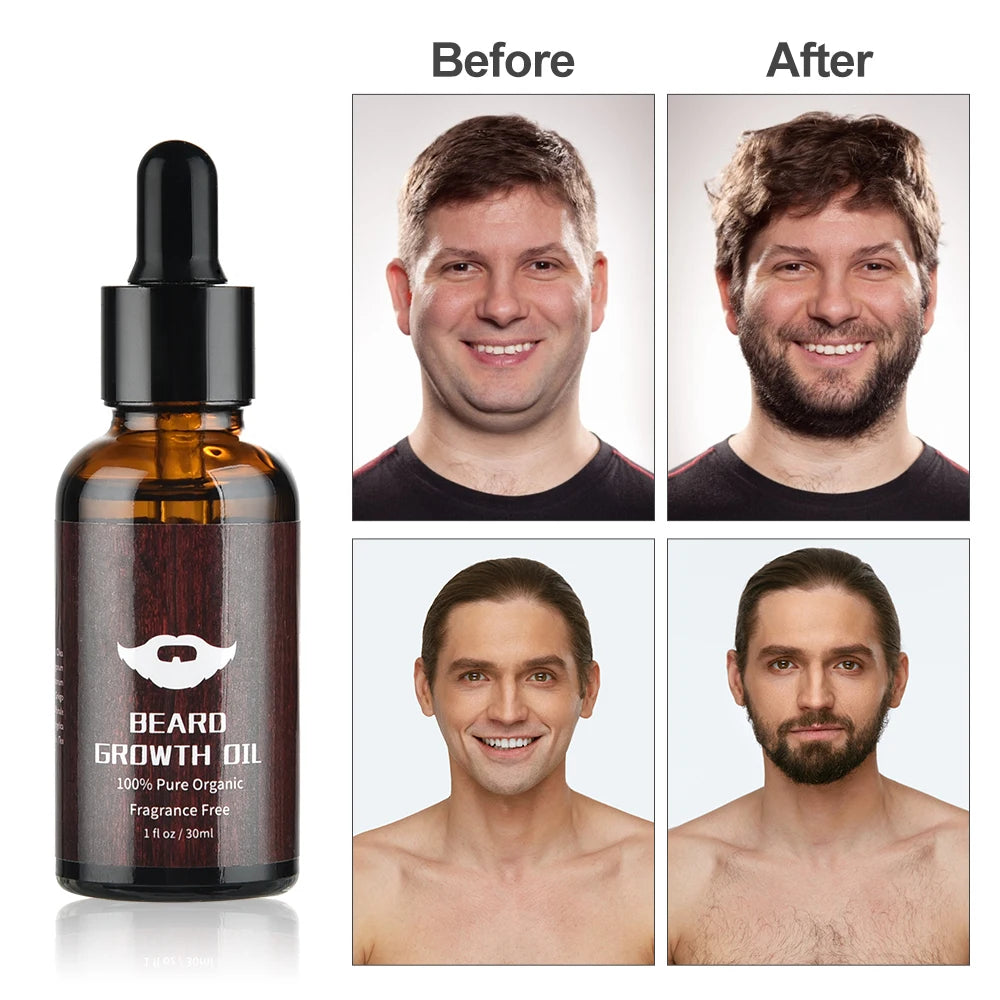 Beard Growth Kit Barber Hair Growth Enhancer Set Oil Serum Nourishing Essential Facial Care Kit Men Titanium Roller Balm Comb